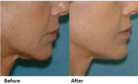 dr godin facial plastic surgeon richmond virginia